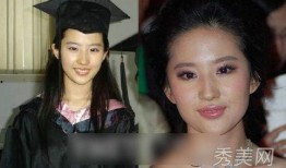 男明星整容爆料视频